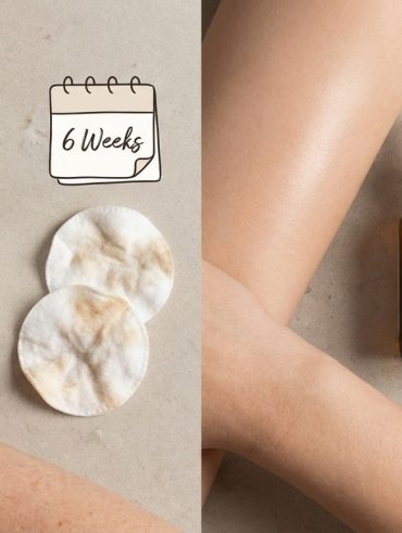 This $24 Retinol Gave Me Purging for 6 Weeks Before My Skin Transformed Completely