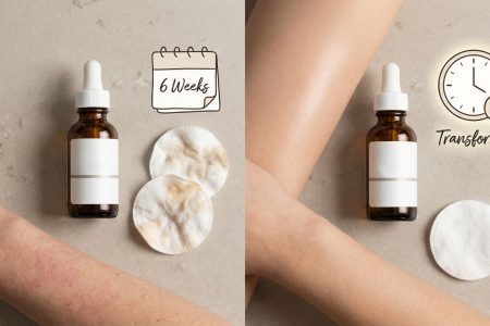 This $24 Retinol Gave Me Purging for 6 Weeks Before My Skin Transformed Completely